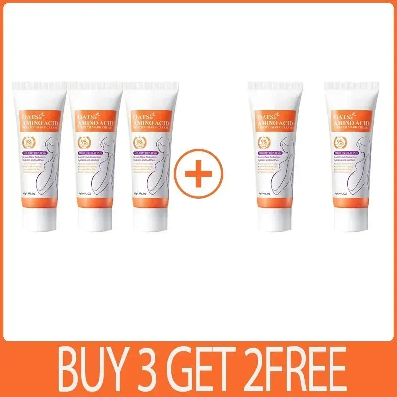 MaternGlow™: Stretch Mark Removal Cream 🤰💖✨