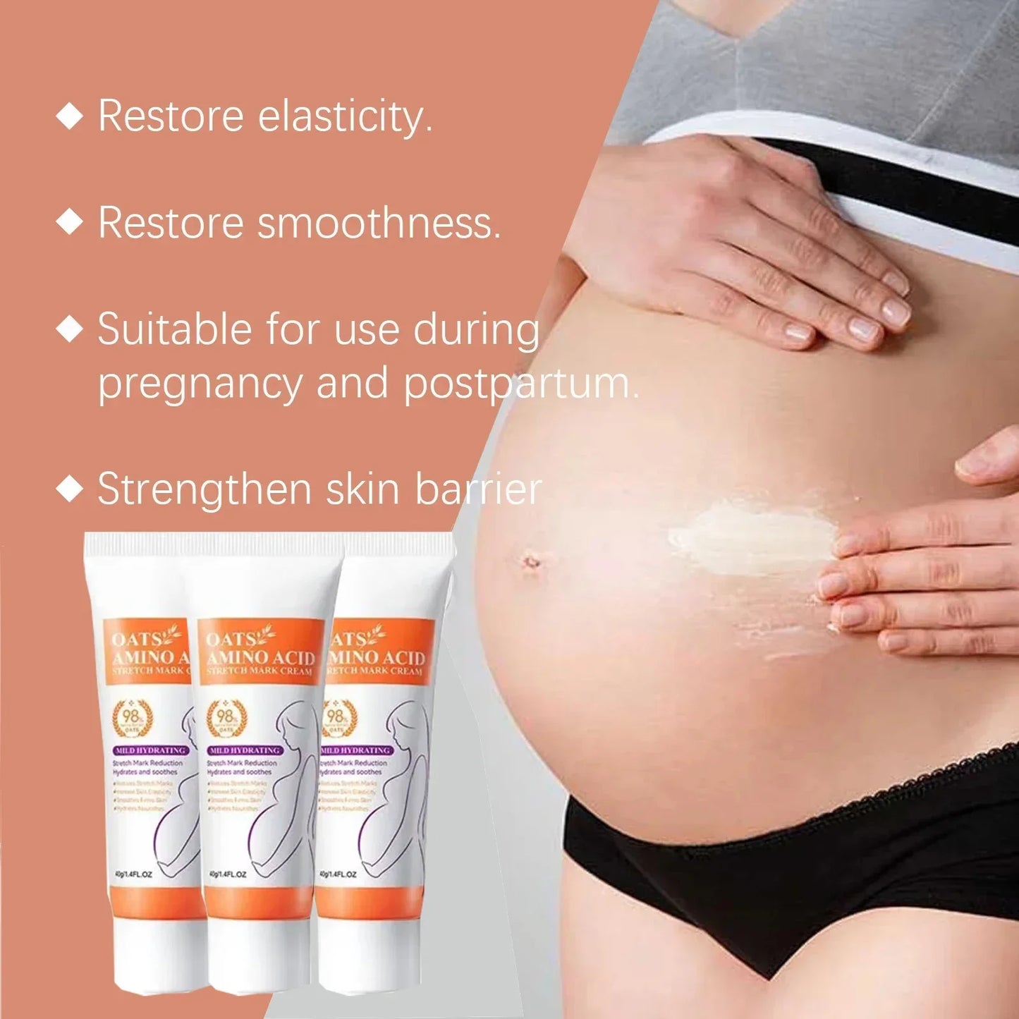 MaternGlow™: Stretch Mark Removal Cream 🤰💖✨