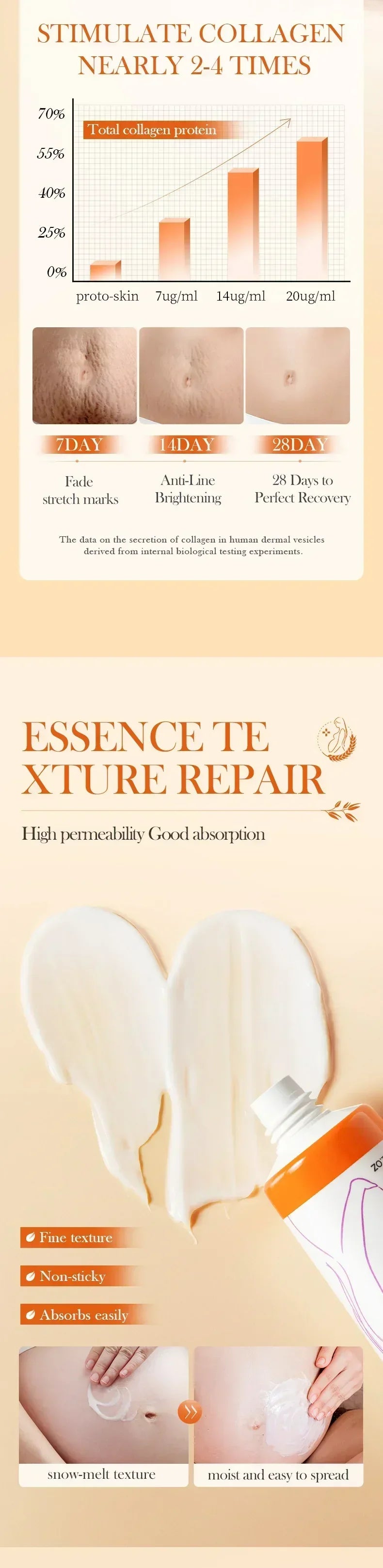 MaternGlow™: Stretch Mark Removal Cream 🤰💖✨