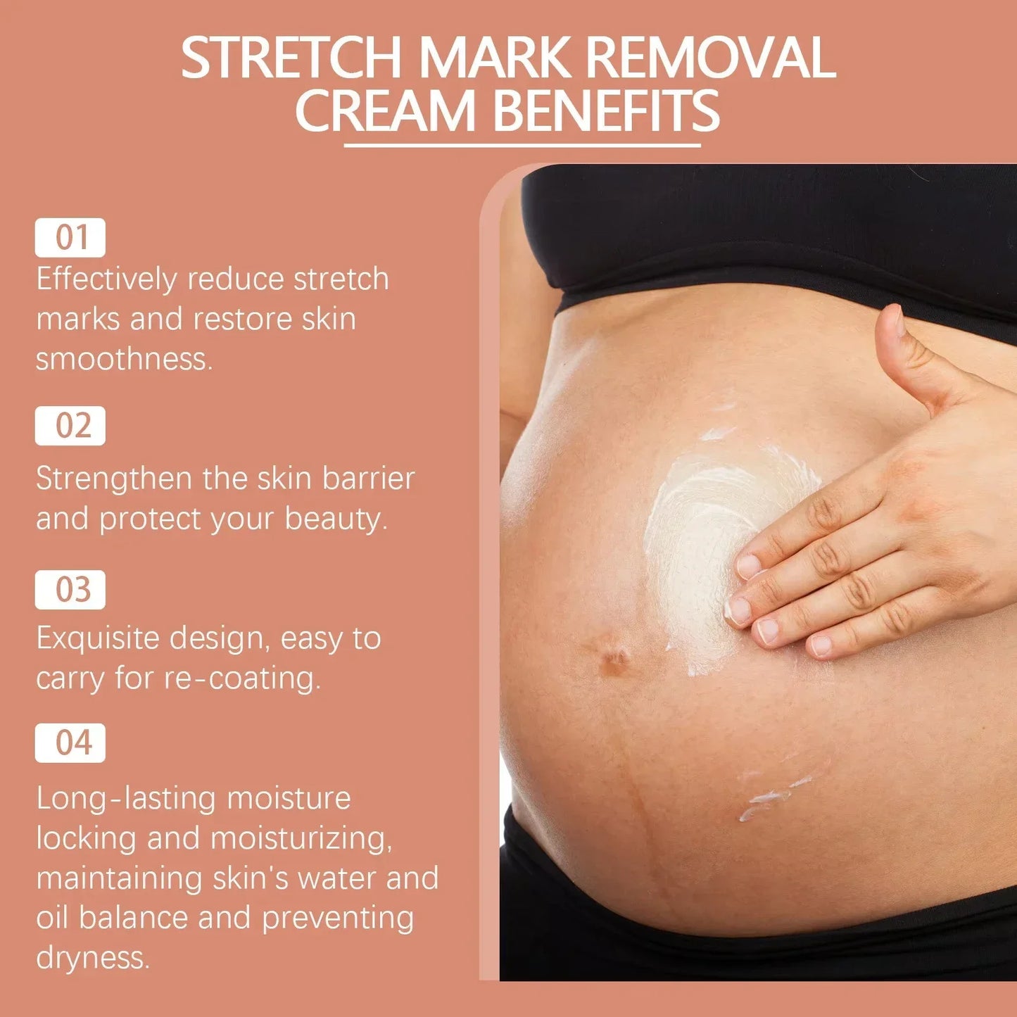 MaternGlow™: Stretch Mark Removal Cream 🤰💖✨