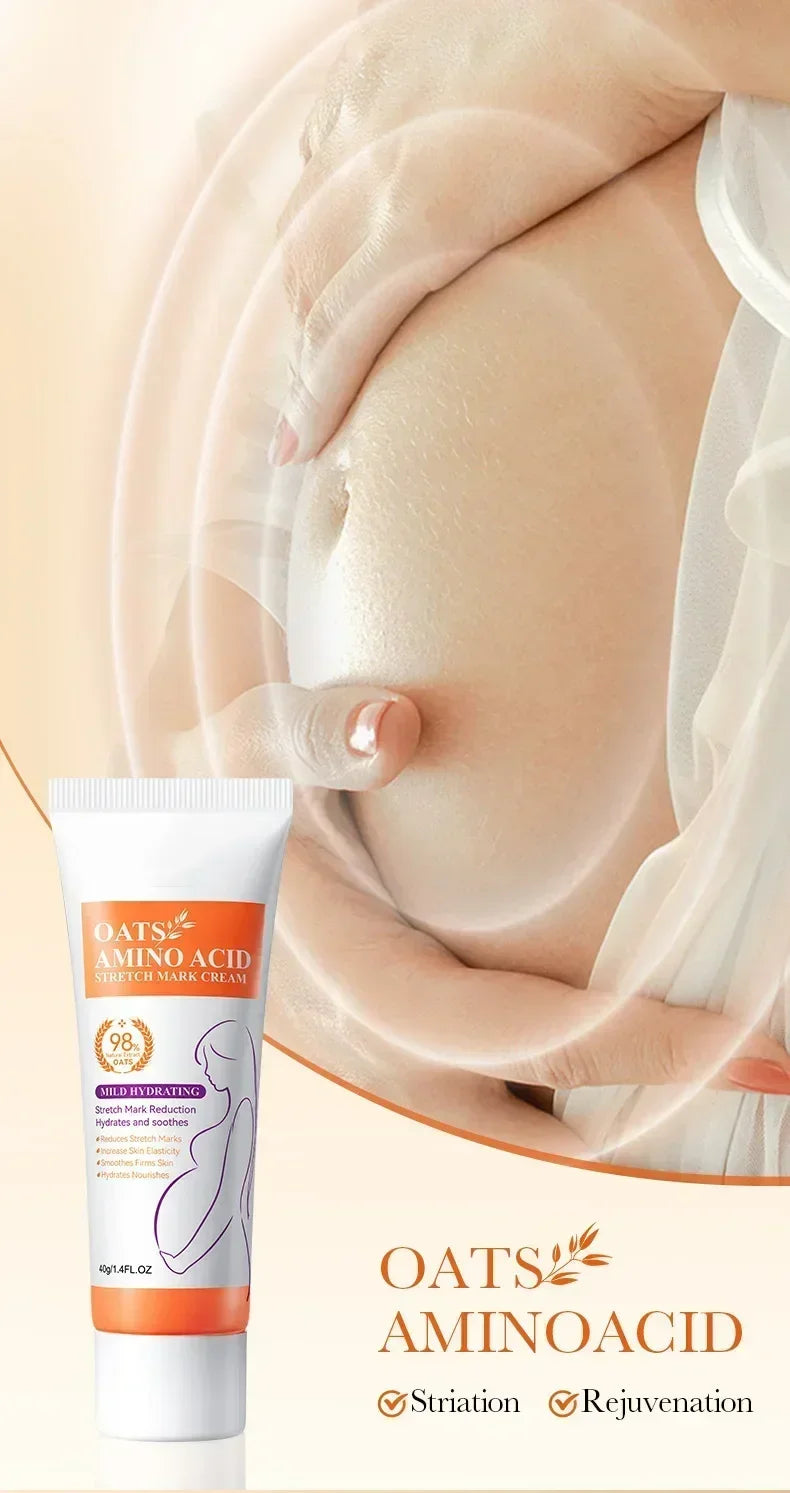 MaternGlow™: Stretch Mark Removal Cream 🤰💖✨