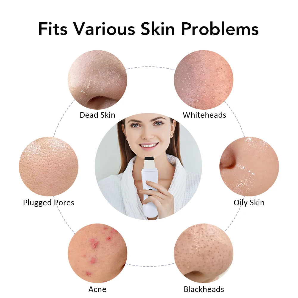 GlowSonic™: Ultrasonic Facial Skin Scrubber 💆‍♀️🌸✨