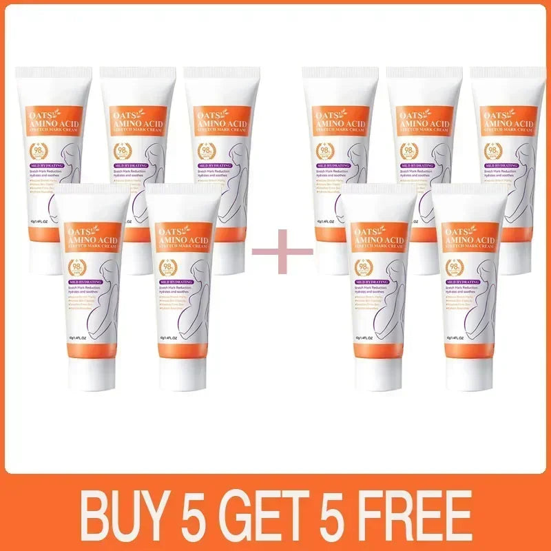 MaternGlow™: Stretch Mark Removal Cream 🤰💖✨