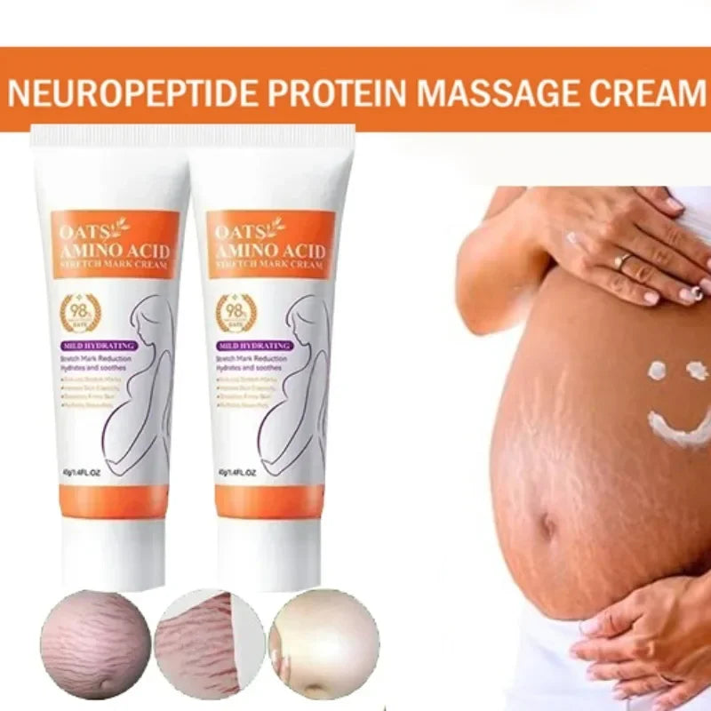 MaternGlow™: Stretch Mark Removal Cream 🤰💖✨