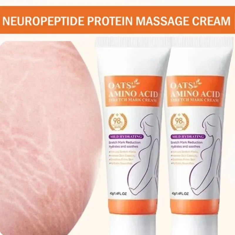 MaternGlow™: Stretch Mark Removal Cream 🤰💖✨